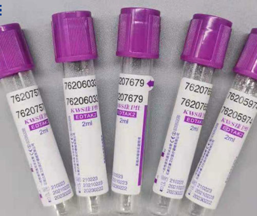 Determination of Fluoride and EDTA in Vacutainer