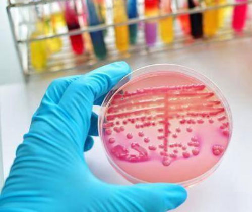 Detection of Sulfate in Microbial Culture Medium