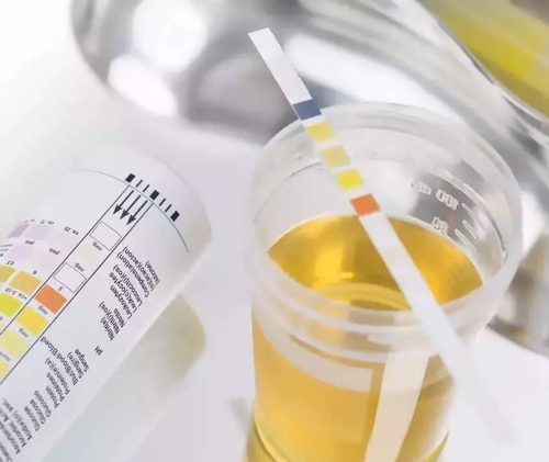 Detection of Ions in Human Urine